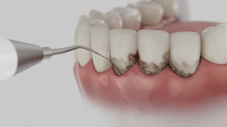 Reliable Dental contractor in Waverly, OH by Dentist Open Now